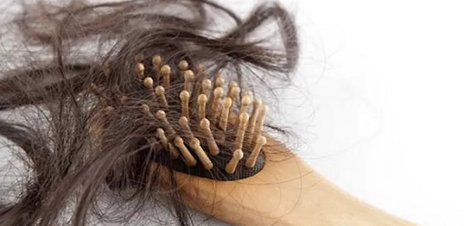 Rekomendasi Shampoo Mengatasi Rambut Rontok Terbaik